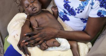 South Sudan government buried reports which suggest oil pollution is causing miscarriages and ‘alarming’ birth defects in children